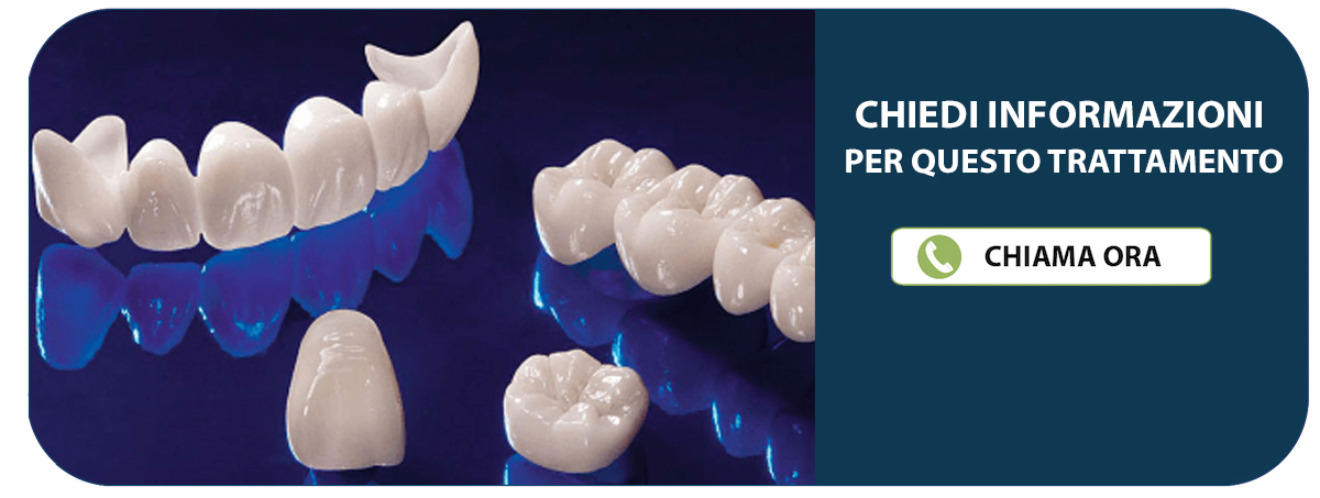 Dentista Rovigo (Castelguglielmo) - Studio Dentistico Ferrari