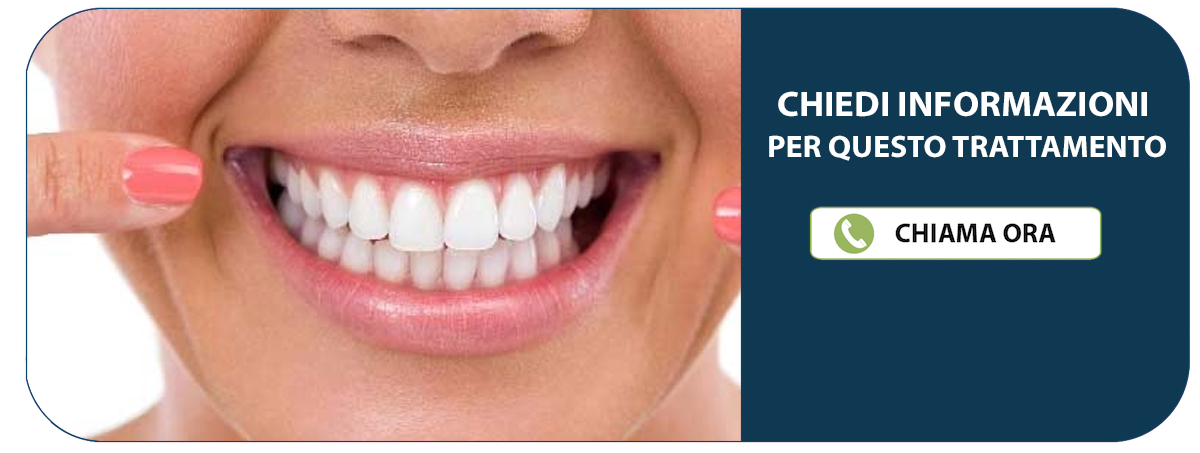 Dentista Rovigo (Castelguglielmo) - Studio Dentistico Ferrari