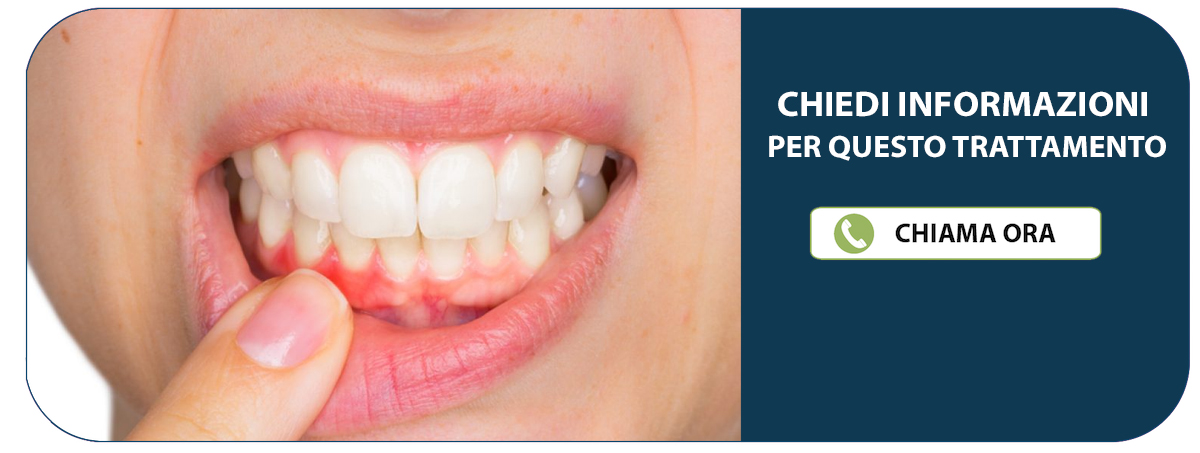 Dentista Rovigo (Castelguglielmo) - Studio Dentistico Ferrari