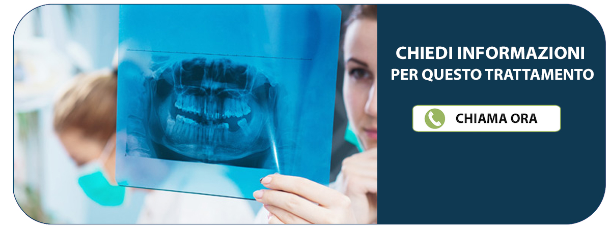 Dentista Rovigo (Castelguglielmo) - Studio Dentistico Ferrari
